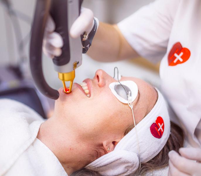 Couperosebehandeling